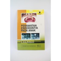 Perawatan Endodontik Pada Anak