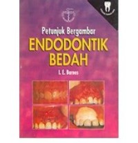 Petunjuk Bergambar Endodontik Bedah