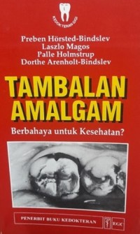 Tambalan Amalgam Berbahaya Untuk Kesehatan ?